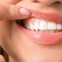 جراحی های لثه در کلینیک دکتر کوثری